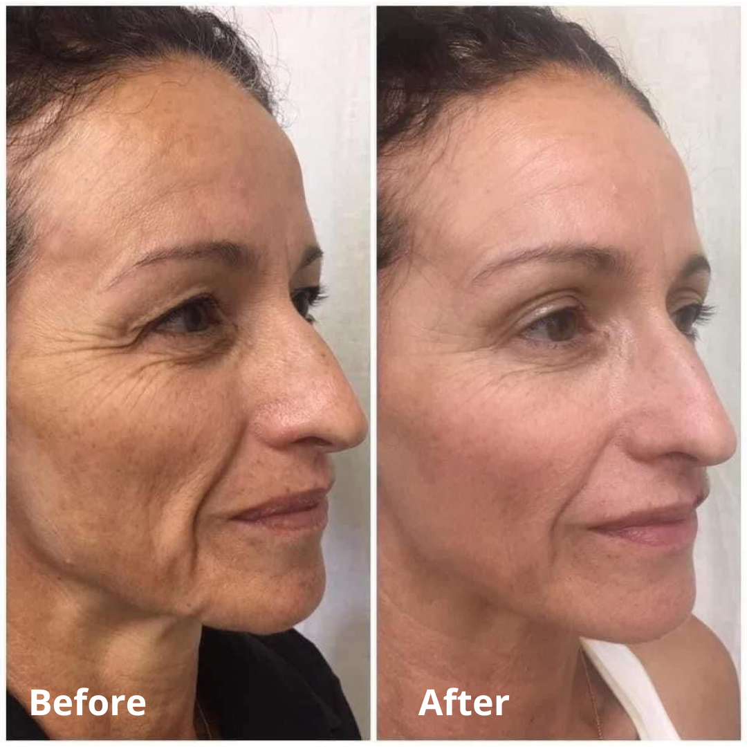 Beautibella™ Wrinkle Cream