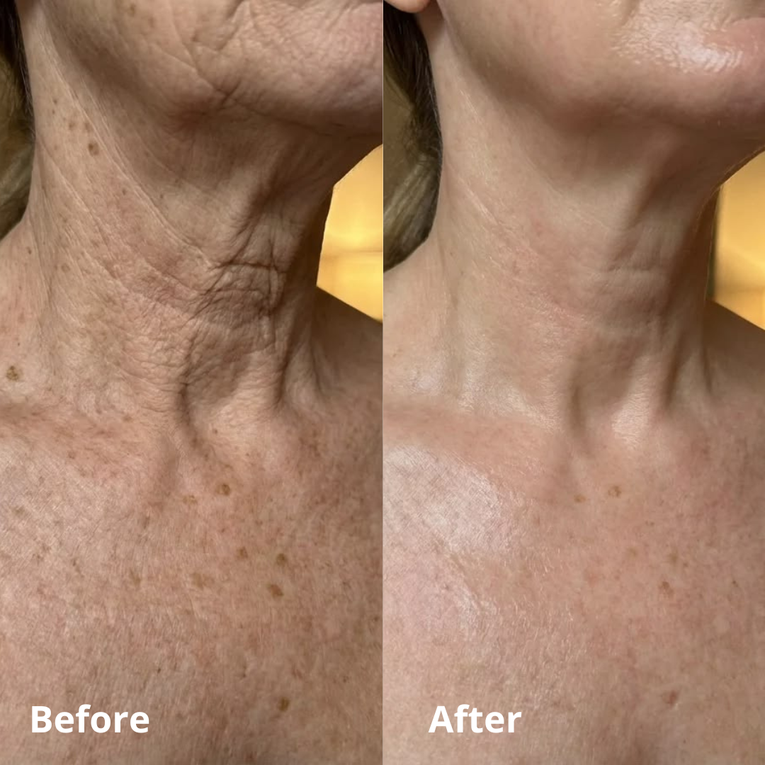 Beautibella™ Wrinkle Cream